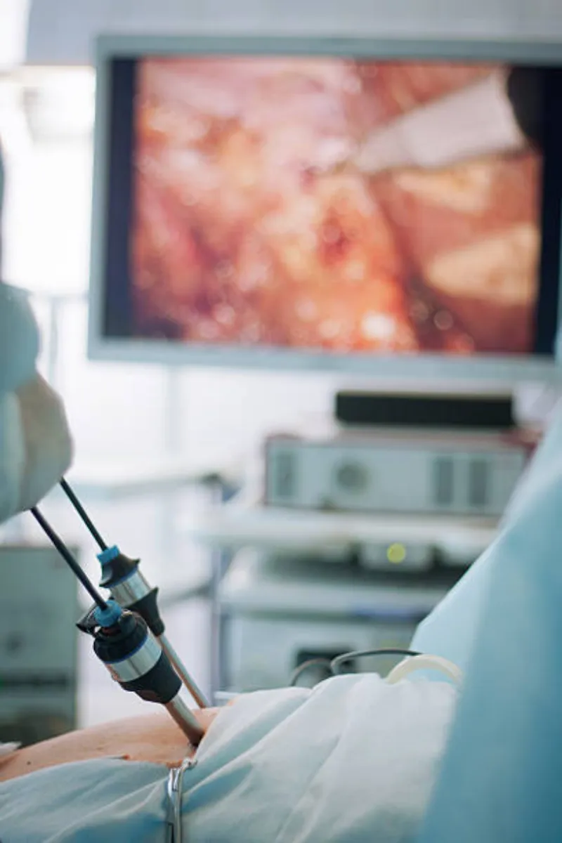 Sistema de monitoramento para videocirurgia em Goiás